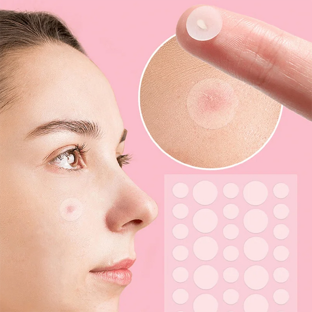 Pimple Patches