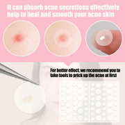 Pimple Patches
