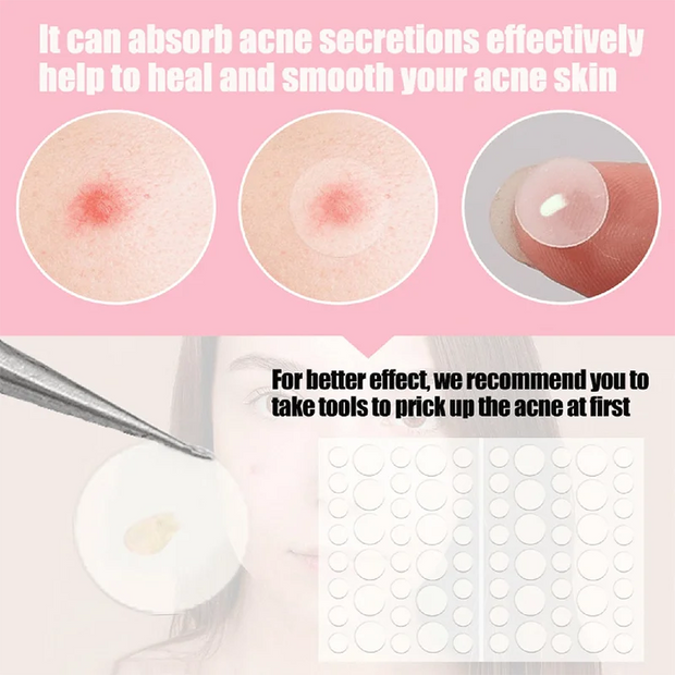 Pimple Patches