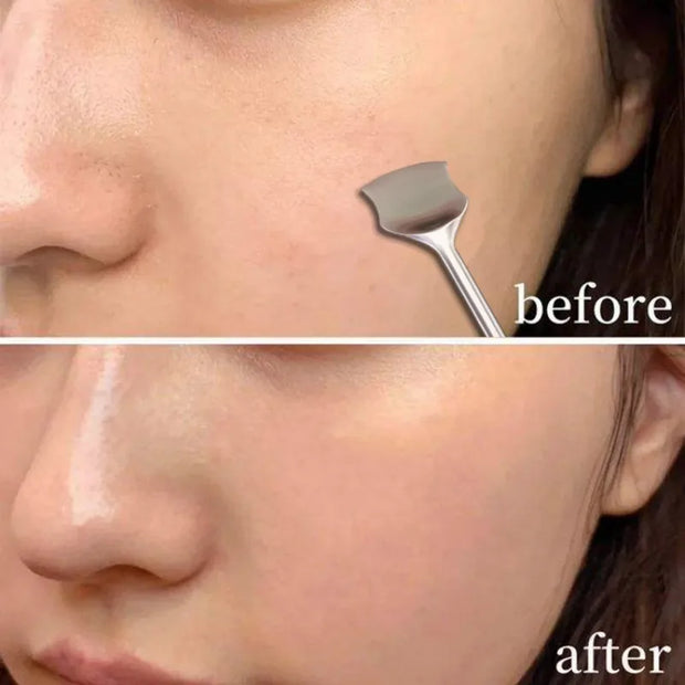 Double Headed Blackhead Remover
