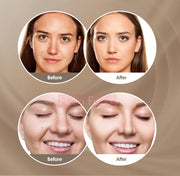 Facial LED Light Mask