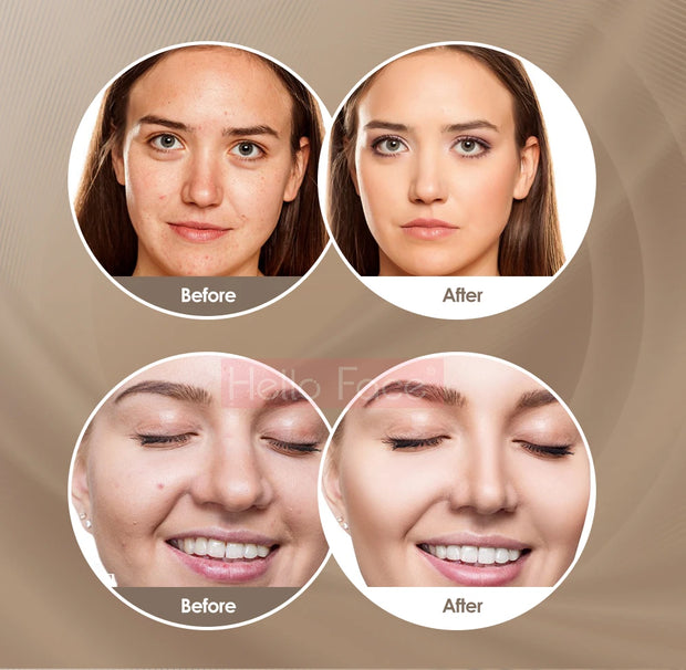 Facial LED Light Mask